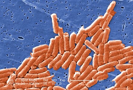 Bacteria gram negative photo