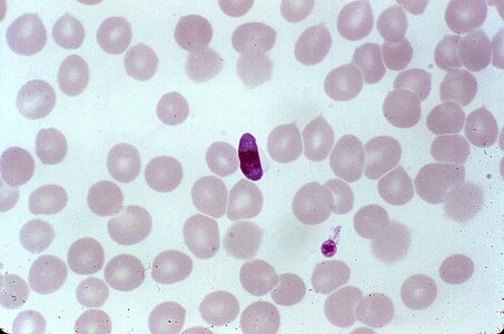 Blood blood cell cervical smear photo