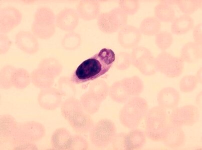 Malaria monocyte parasit