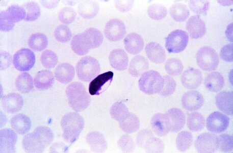 Plasmodium  