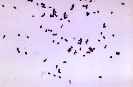 Clostridium gram photomicrograph photo
