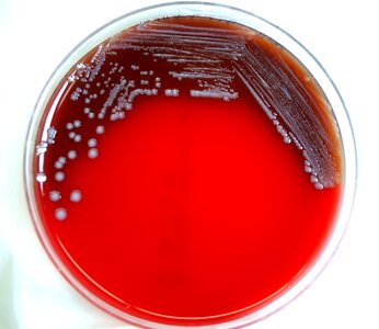 Blood Agar blood analysis petri dish