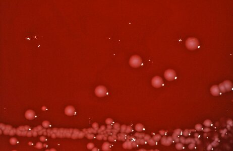 Bacteria blood colonial photo