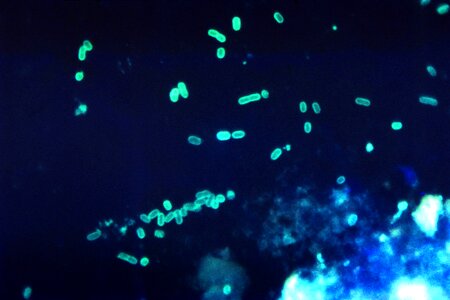 Antibody escherichia gram photo