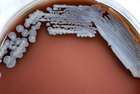 Bacteria chocolate means