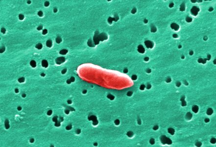 Gram negative 