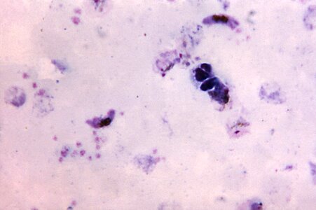 Crescent note plasmodium