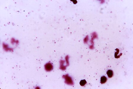 Blood cervical smear film