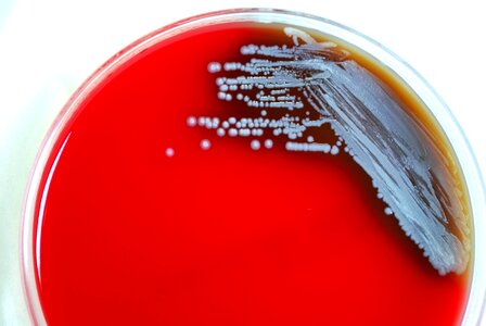 Disease infection 