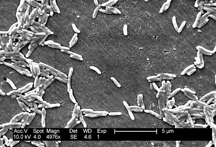 Fetus vibrio 