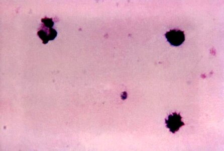 Crescent plasmodium trophozoite photo