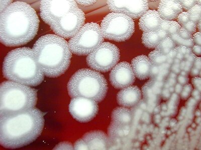 Bacillus blood blood agar