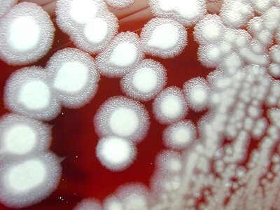 Bacillus blood blood agar photo