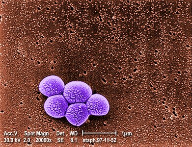 Bacteria grouping methicillin
