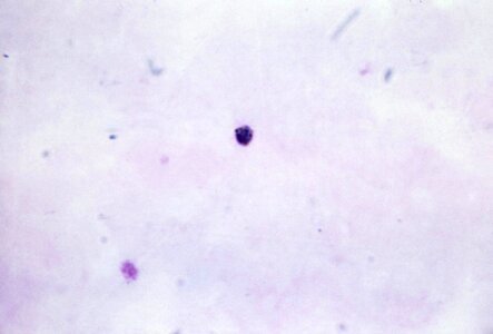 Crescent gametocyte plasmodium photo