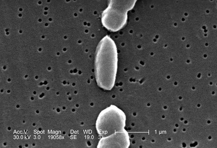 Bacteria number vibrio photo