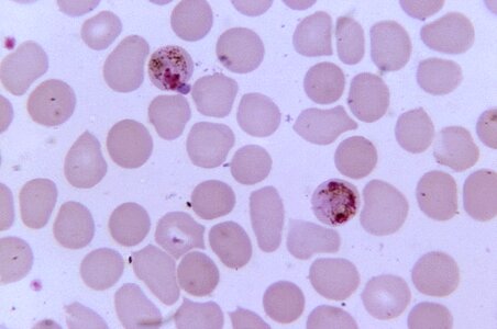 Plasmodium  