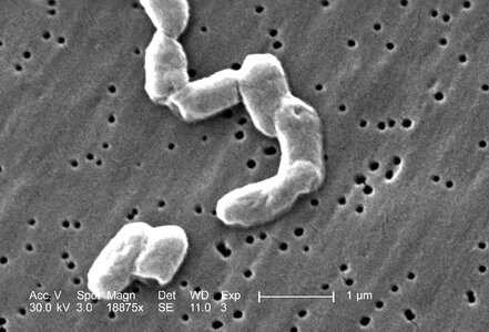 Bacteria gram magnification photo