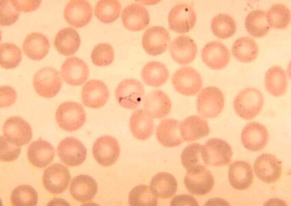 Parasit plasmodium ring