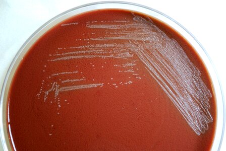 Bacteria blood blood agar photo