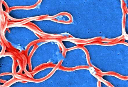 Bacteria Borrelia spirochaetaceae gram photo