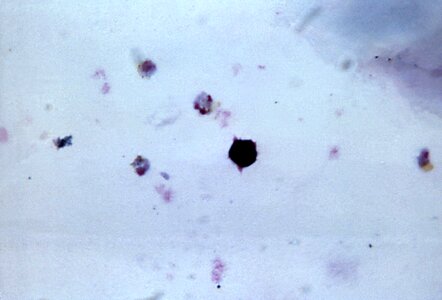 Chromatin crescent cytoplasm