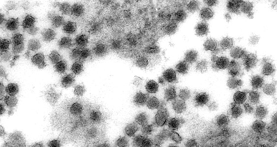 Electron electron micrograph virus photo