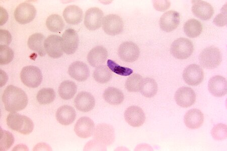 Blood cervical smear film