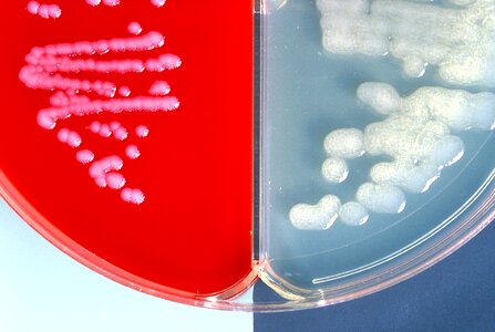 Bacillus blood encapsulation photo