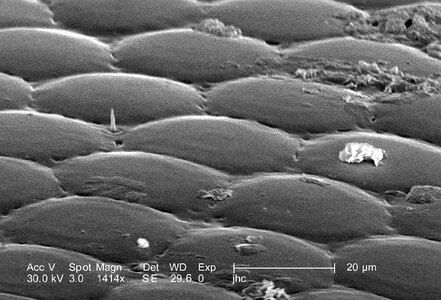 Bug eye morphology