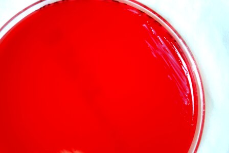 Bacteria blood agar celsius photo