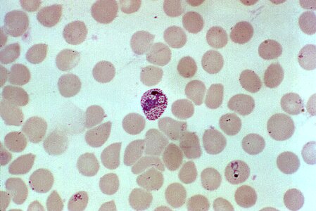 Blood breast cell photo