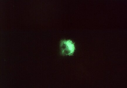 Autumn chlamydia psittacosis