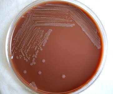 Blood Agar blood analysis petri dish