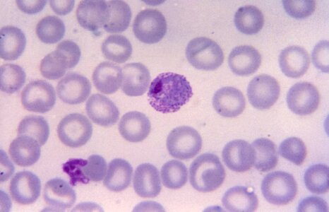 Blood Cell cell division photomicrograph photo