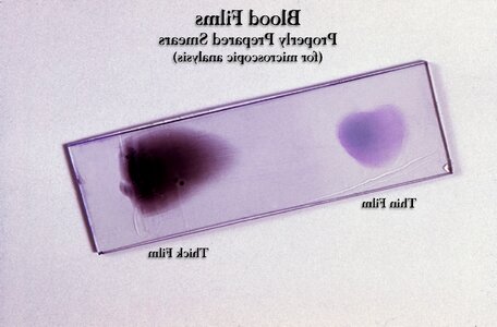 Blood example film
