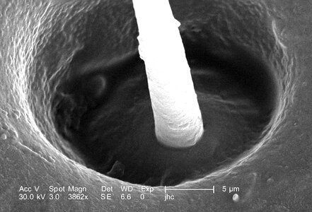 Base electron electron micrograph photo