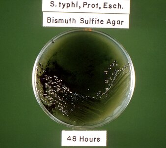 Bacteria bismuth incubation photo