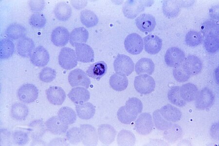 Labor plasmodium photo