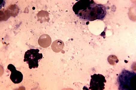 Autopsy diving liver