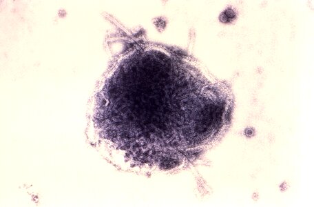 Measles paramyxovirus simian photo