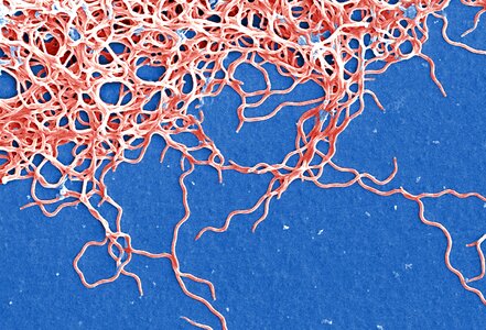 Bacteria Borrelia spirochaetaceae gram photo