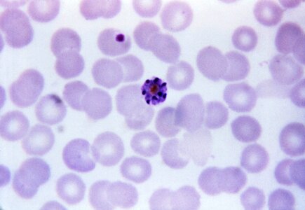 Plasmodium photo