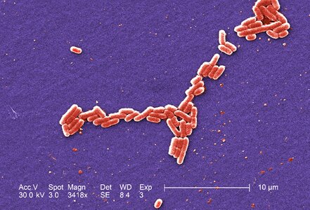 Bacteria escherichia gram photo
