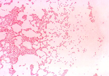 Cause coccobacillus coloration photo