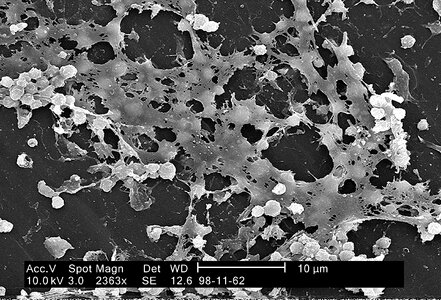 Bacteria electron electron micrograph
