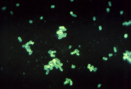 Antibody bacteria escherichia