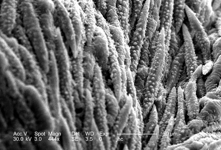 Electron electron micrograph morphologic photo