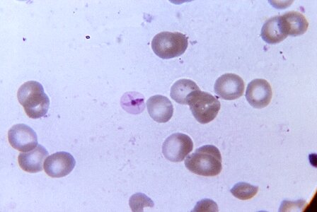 Form morphology parasit