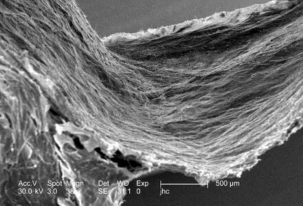Details electron electron micrograph photo